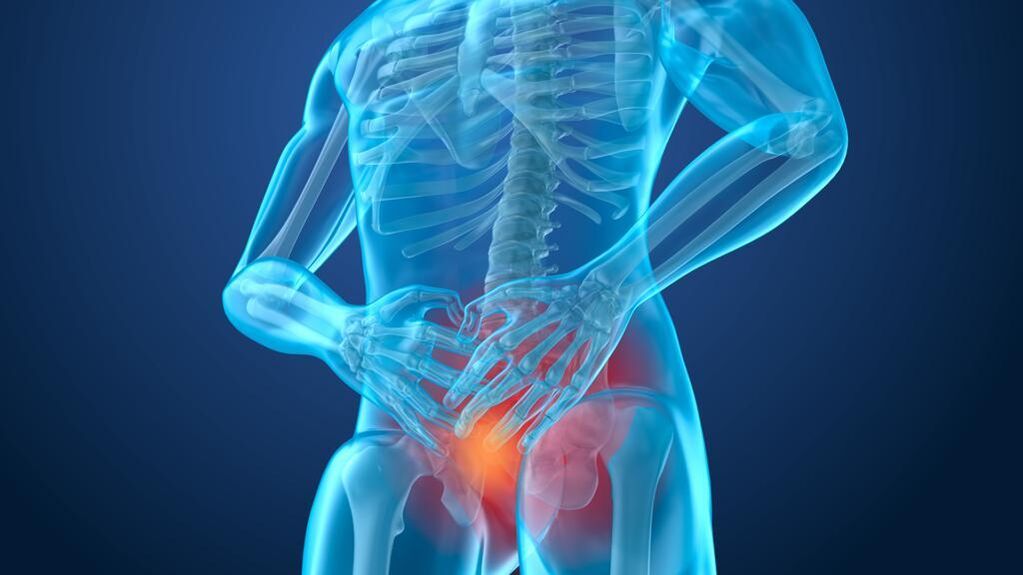 Bolovi u leđima: dijagnoza i liječenje | Službene stranice Cannabis Oil