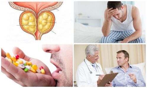 prostatitis kod muškaraca